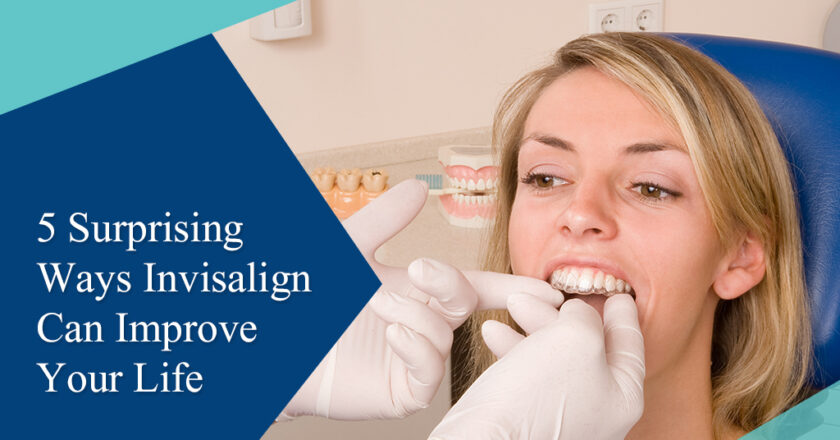 5 Surprising Ways Invisalign Can Improve Your Life