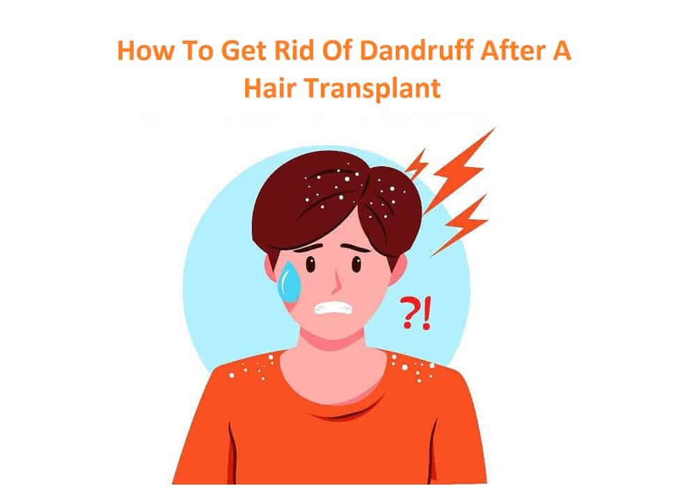 How to Get Rid of Dandruff After A Hair Transplant?